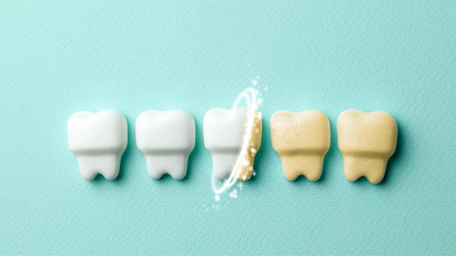 ฟันเหลืองเกิดจากอะไร