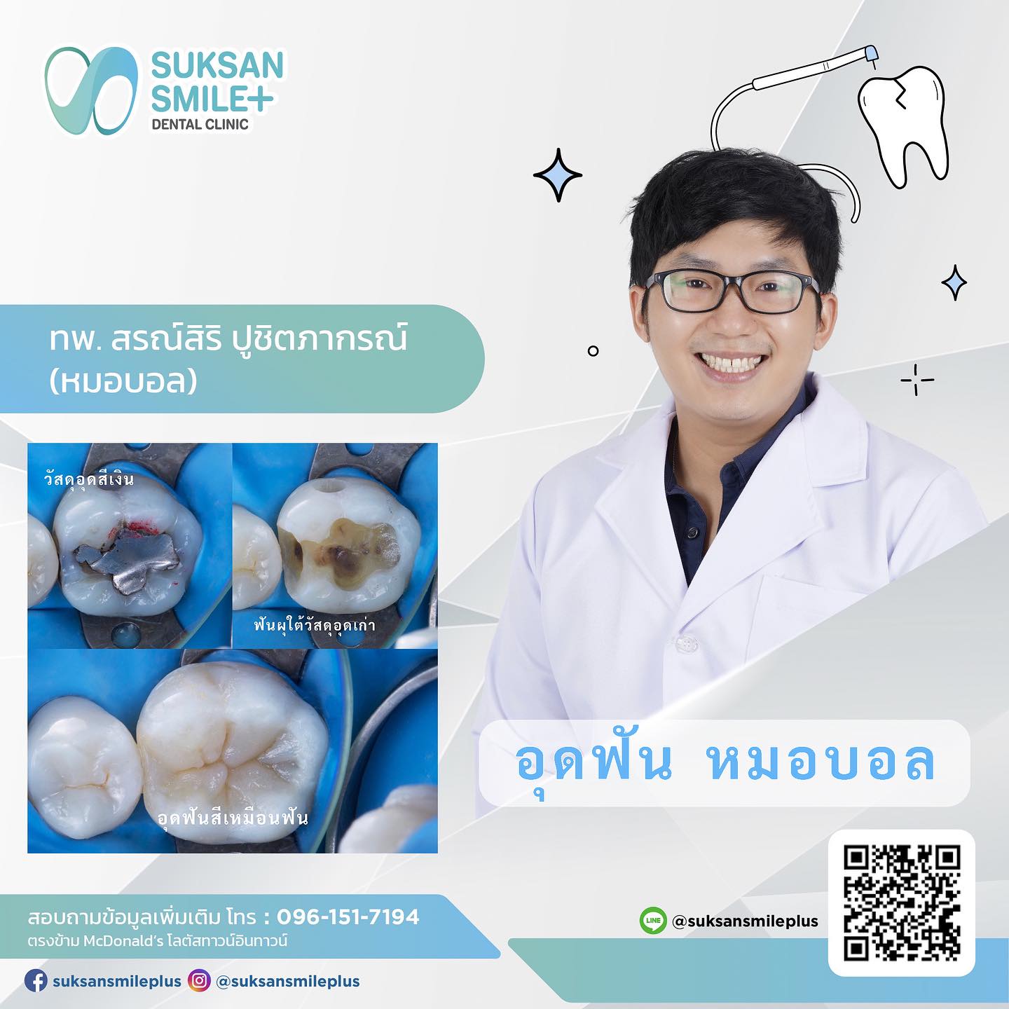 \u0e2d\u0e38\u0e14\u0e1f\u0e31\u0e19 \u0e21\u0e35\u0e01\u0e35\u0e48\u0e41\u0e1a\u0e1a \u0e43\u0e0a\u0e49\u0e27\u0e31\u0e2a\u0e14\u0e38\u0e2d\u0e30\u0e44\u0e23\u0e1a\u0e49\u0e32\u0e07 \u0e40\u0e08\u0e47\u0e1a\u0e44\u0e2b\u0e21 \u0e23\u0e32\u0e04\u0e32\u0e40\u0e17\u0e48\u0e32\u0e44\u0e2b\u0e23\u0e48 \u0e2d\u0e38\u0e14\u0e1f\u0e31\u0e19\u0e17\u0e35\u0e48\u0e44\u0e2b\u0e19\u0e14\u0e35