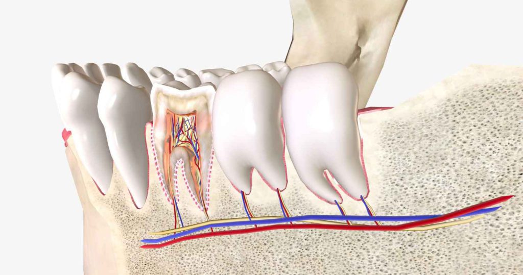 ฟันผุทะลุโพรงประสาทป้องกันยังไง